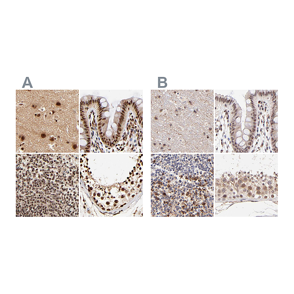 Atlas Antibodies Anti-MED12 Antibody