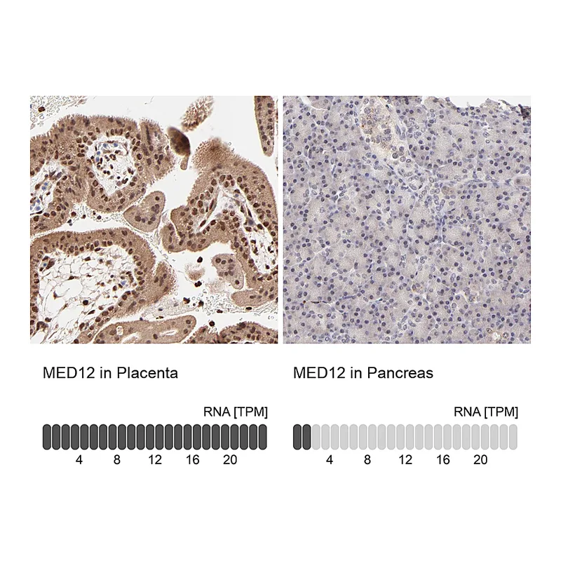 Atlas Antibodies Anti-MED12 Antibody