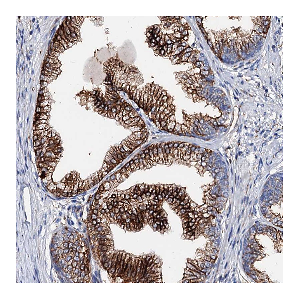 Atlas Antibodies Anti-MED13L Antibody