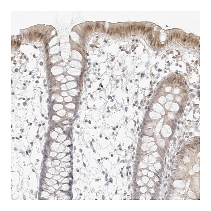 Atlas Antibodies Anti-MED18 Antibody