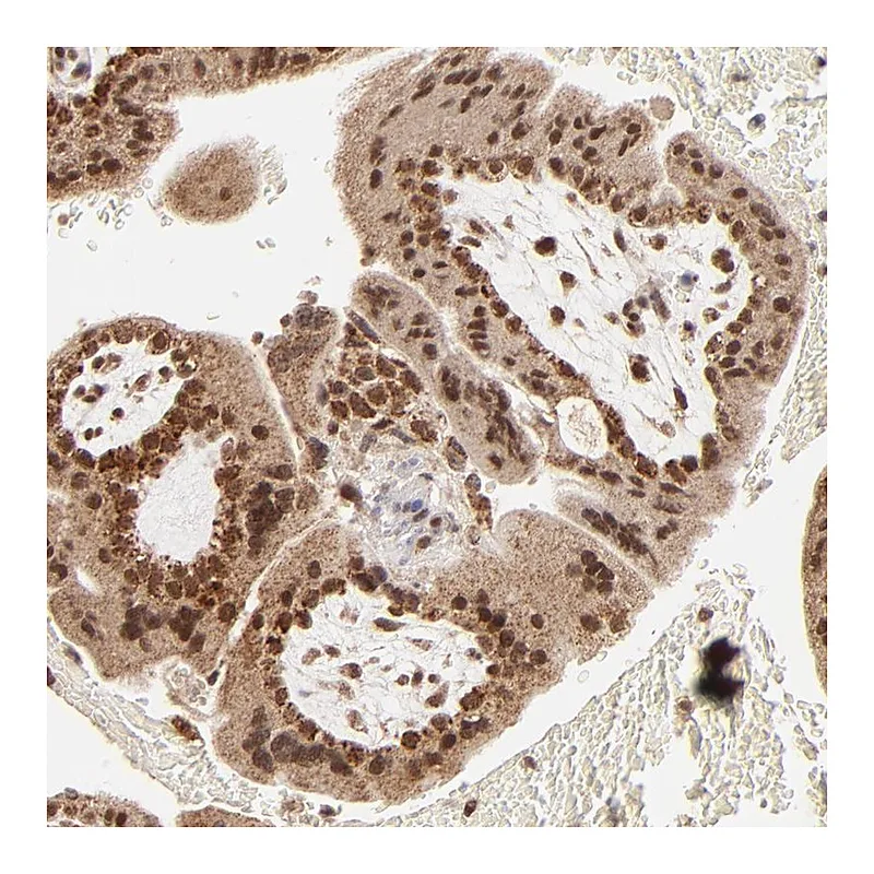 Atlas Antibodies Anti-MED15 Antibody