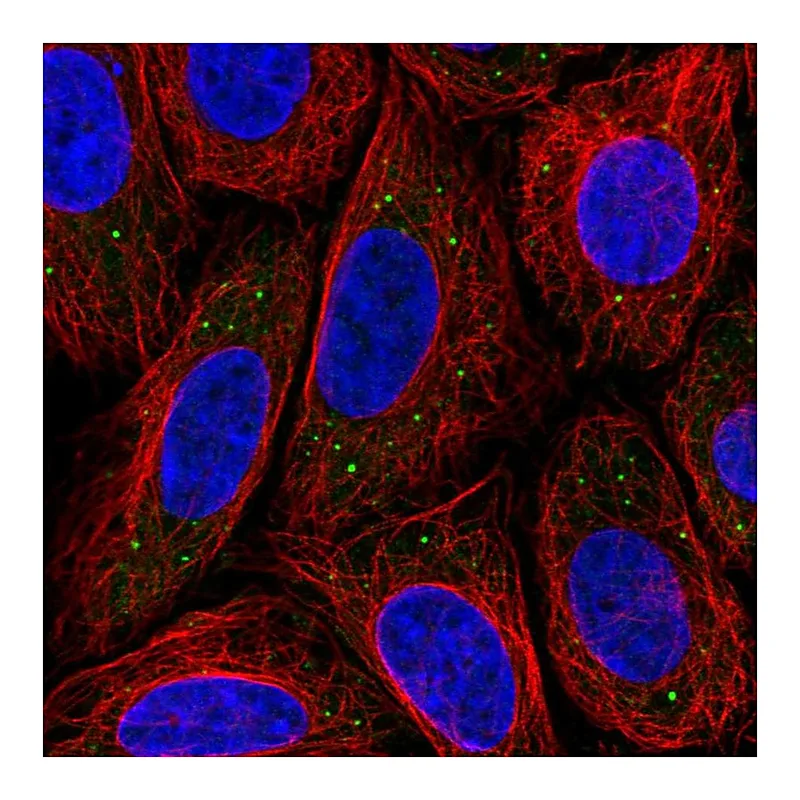 Atlas Antibodies Anti-MED17 Antibody