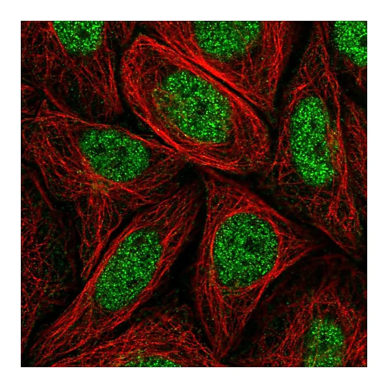 Atlas Antibodies Anti-MED14 Antibody
