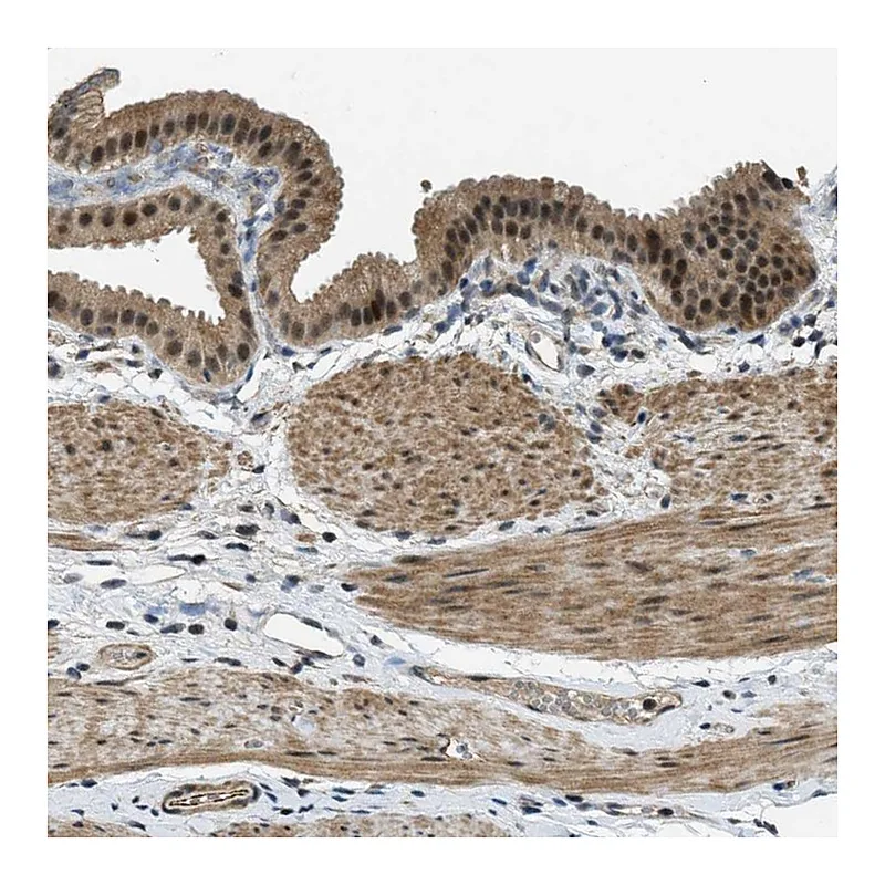 Atlas Antibodies Anti-MED21 Antibody