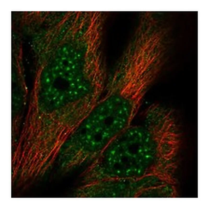 Atlas Antibodies Anti-MED17 Antibody