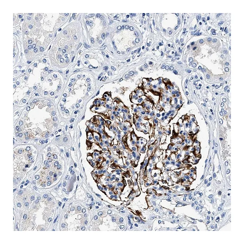 Atlas Antibodies Anti-MED22 Antibody
