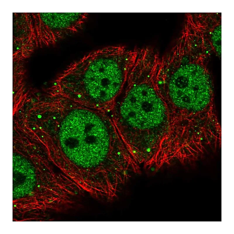 Atlas Antibodies Anti-MED26 Antibody