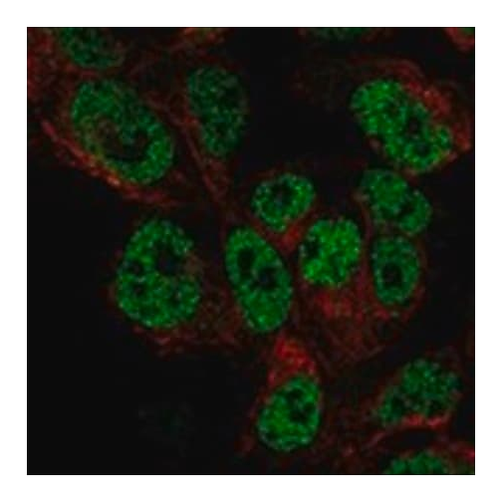 Merck Anti-DACH1 antibody produced in rabbit