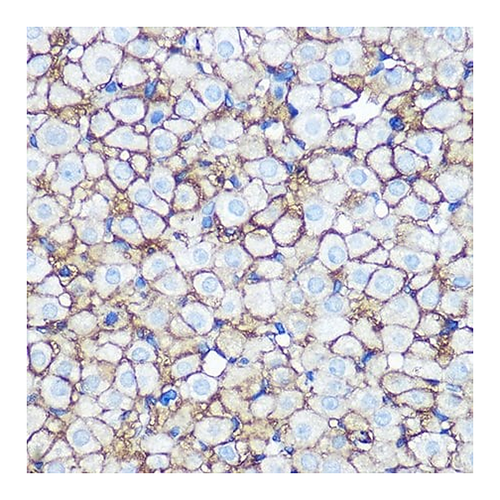 Merck Anti-Annexin A2 antibody produced in rabbit