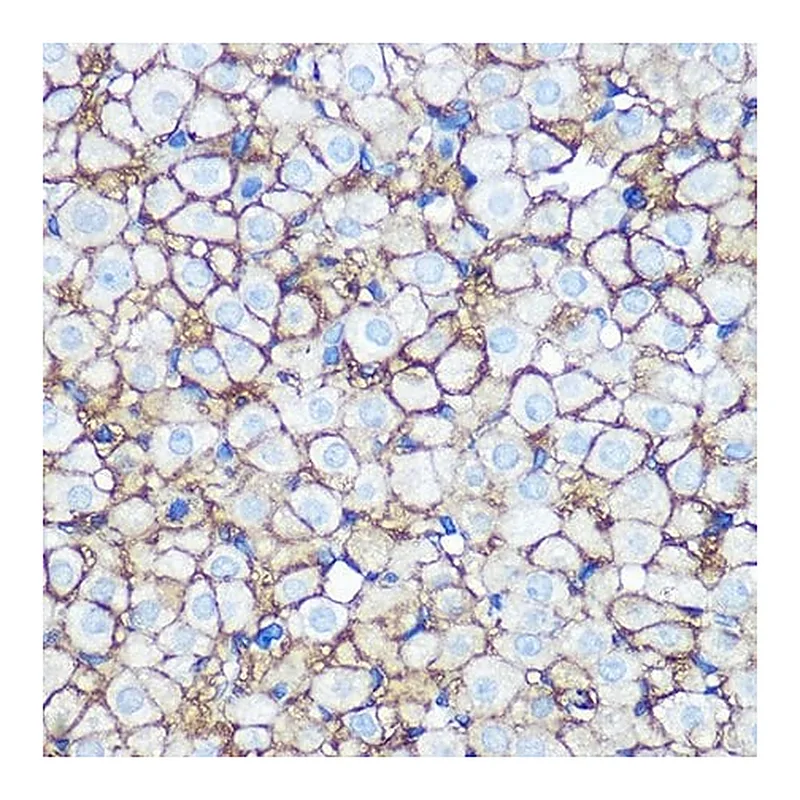 Merck Anti-Annexin A2 antibody produced in rabbit