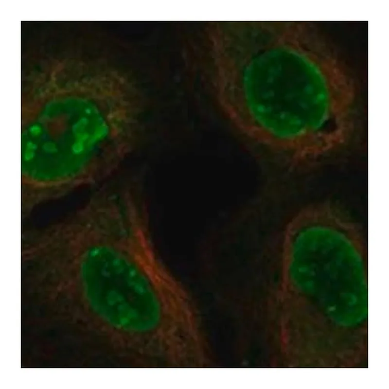 Merck Anti-DDX5 antibody produced in rabbit