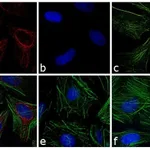 Thermo Fisher Scientific F(ab`)2-Goat anti-Rabbit IgG (H+L) Cross-Adsorbed Secondary Antibody, APC