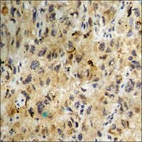 Merck ANTI-PHOSPHO-CASEIN KINASE II ALPHA (PTY