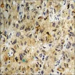 Merck ANTI-PHOSPHO-CASEIN KINASE II ALPHA (PTY