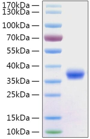 Merck RECOMBINANT 2019-NCOV SPIKE RBD PROTEIN&
