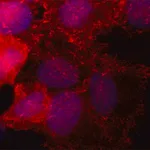 Merck Anti-SORBS2 antibody,Mouse monoclonal