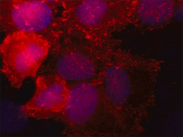 Merck Anti-SORBS2 antibody,Mouse monoclonal