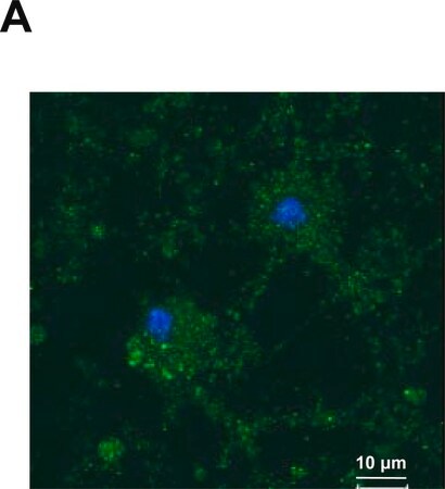 Merck Anti-YB-1 (C-terminal) antibody produced in rabbit