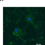 Merck Anti-YB-1 (C-terminal) antibody produced in rabbit