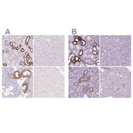 Merck Anti-BSND antibody produced in rabbit
