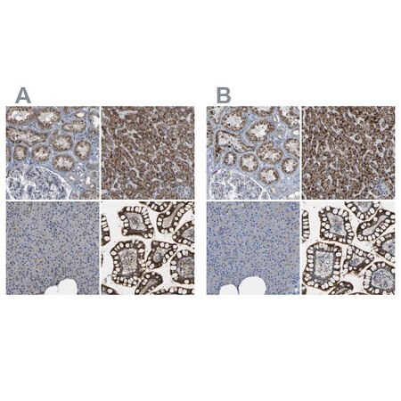 Merck Anti-ACBD5 antibody produced in rabbit