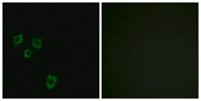 Merck Anti-MUC16 antibody produced in rabbit