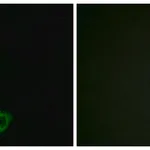 Merck Anti-MUC16 antibody produced in rabbit