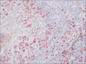 Merck ANTI-CHICKEN IGY (IGG) (WHOLE MOLECULE)&
