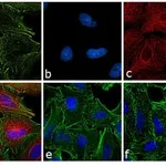 Thermo Fisher Scientific Rabbit anti-Rat IgG (H+L) Cross-Adsorbed Secondary Antibody, Alexa Fluor 594