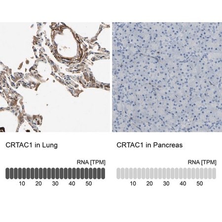 Merck Anti-CRTAC1 antibody produced in rabbit