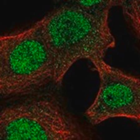 Merck Anti-NAA40 antibody produced in rabbit