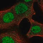 Merck Anti-NAA40 antibody produced in rabbit