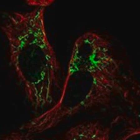 Merck Anti-PLAAT3 antibody produced in rabbit