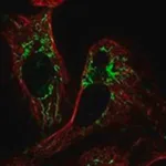 Merck Anti-PLAAT3 antibody produced in rabbit