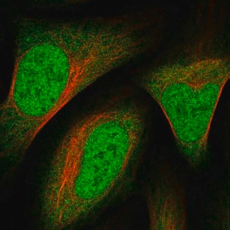 Merck Anti-RHBDL1 antibody produced in rabbit