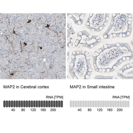 Merck Anti-MAP2 antibody produced in rabbit