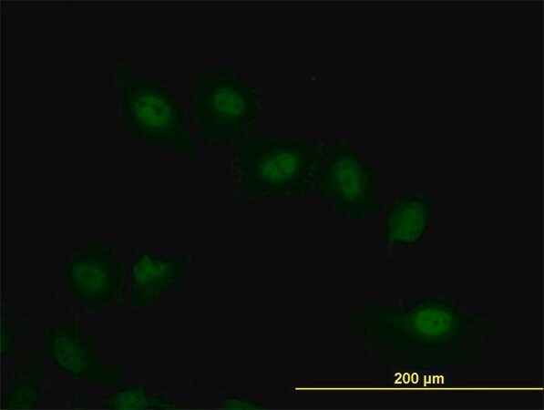Merck Monoclonal Anti-VRK2 antibody produced in mouse