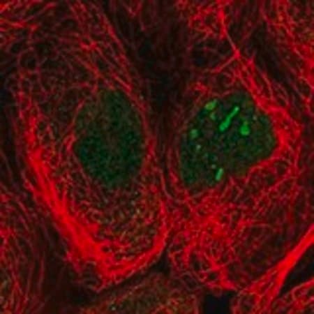 Merck Anti-MYSM1 antibody produced in rabbit