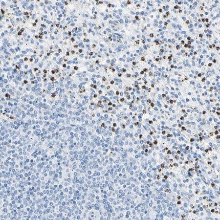 Merck Anti-CYSLTR1 antibody produced in rabbit