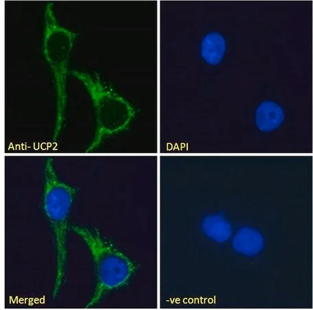 Merck Anti-Uncoupling Protein 2/UCP2 antibody produced in goat