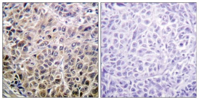 Merck Anti-DAPK1 antibody produced in rabbit