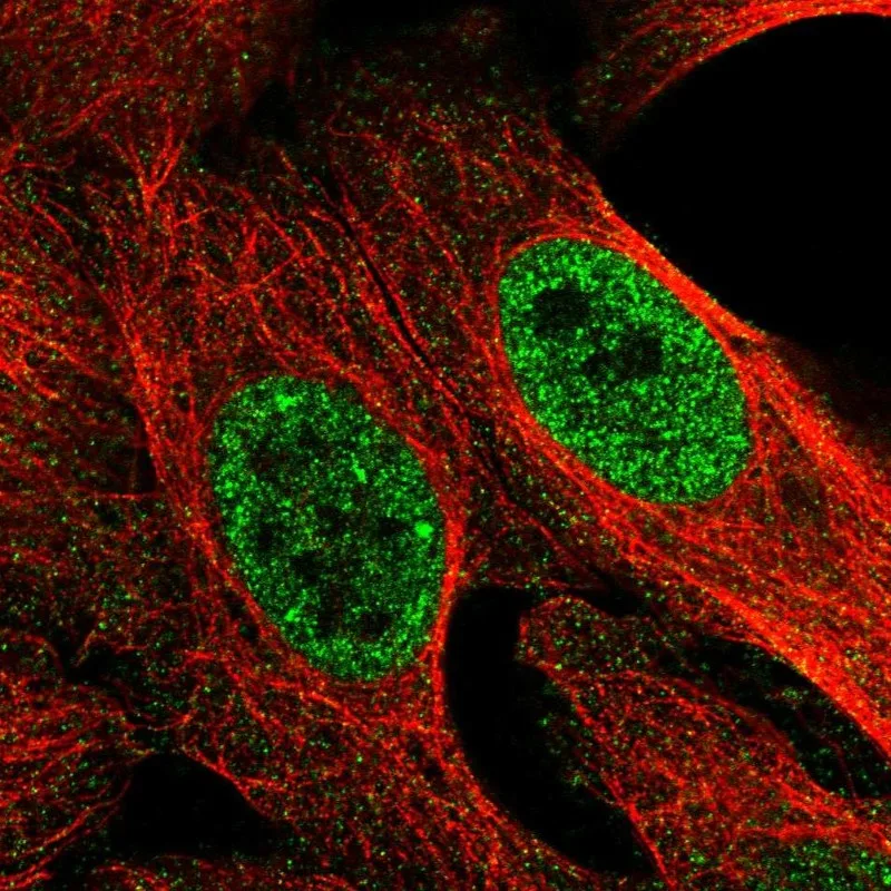 Atlas Antibodies Anti-MED22 Antibody