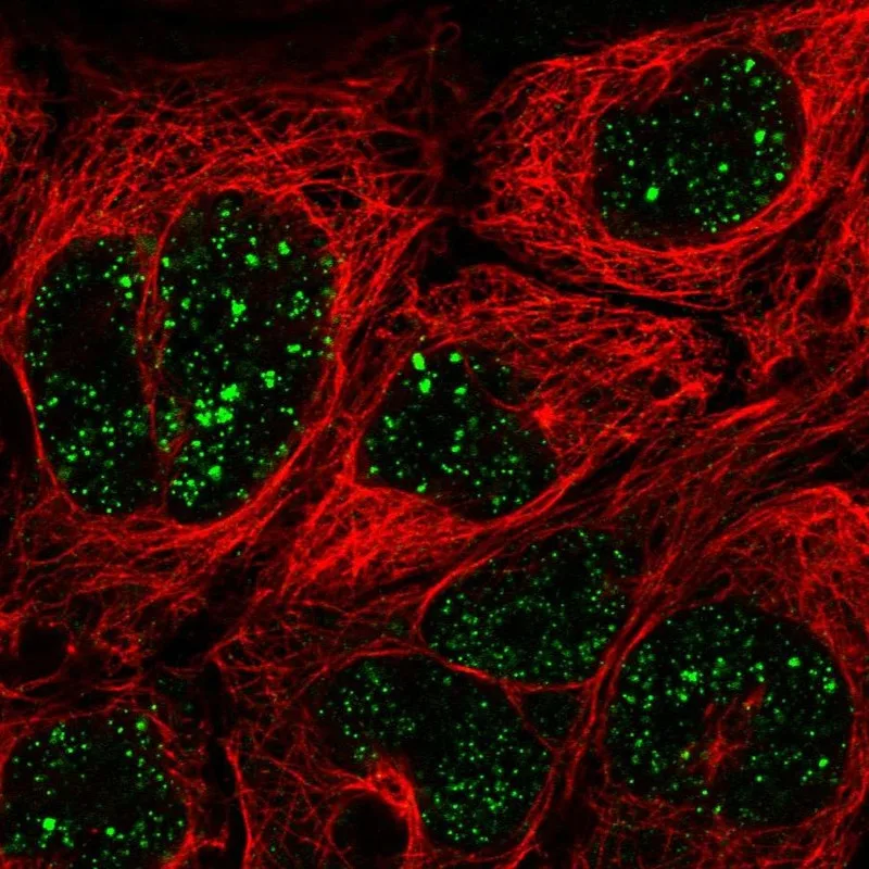 Atlas Antibodies Anti-MED7 Antibody