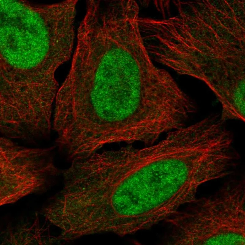 Atlas Antibodies Anti-MED30 Antibody