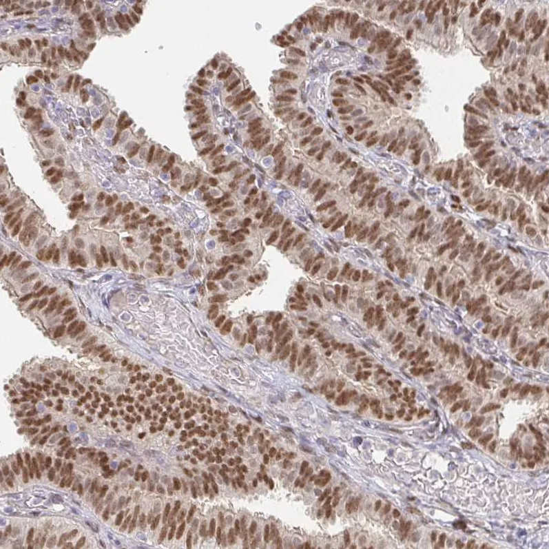 Atlas Antibodies Anti-MEIS1 Antibody