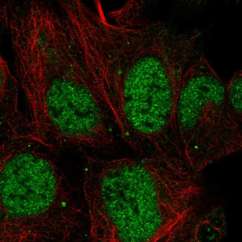 Atlas Antibodies Anti-MESDC1 Antibody