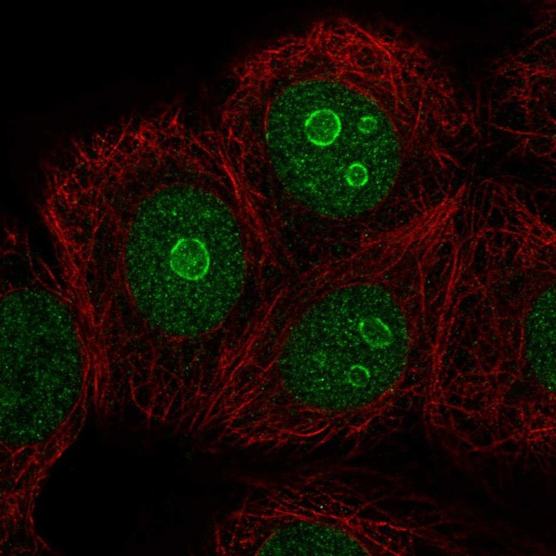 Atlas Antibodies Anti-METTL22 Antibody