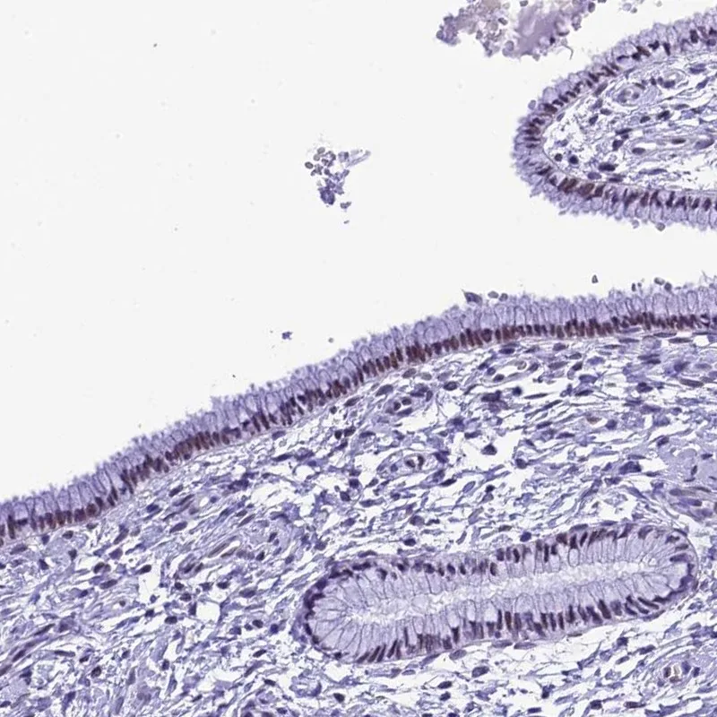 Atlas Antibodies Anti-METTL25 Antibody