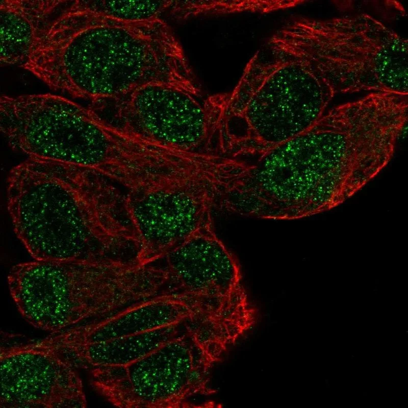 Atlas Antibodies Anti-MFHAS1 Antibody
