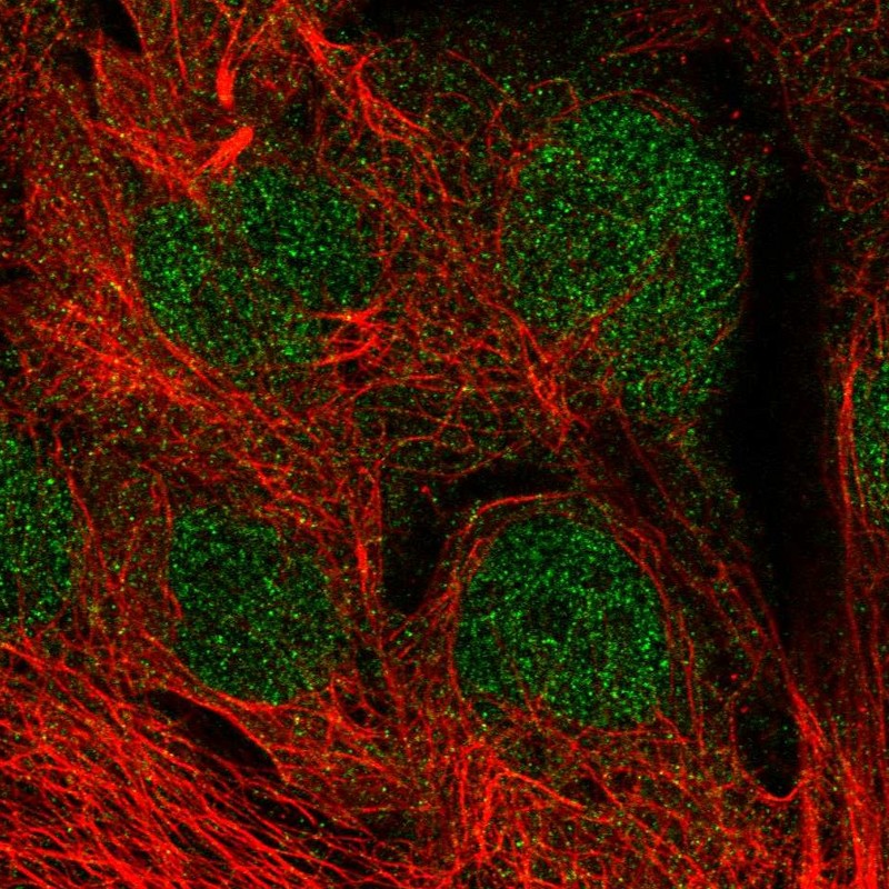 Atlas Antibodies Anti-MGMT Antibody